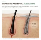 Microneedle Infusion Hair Regrowth Solution
