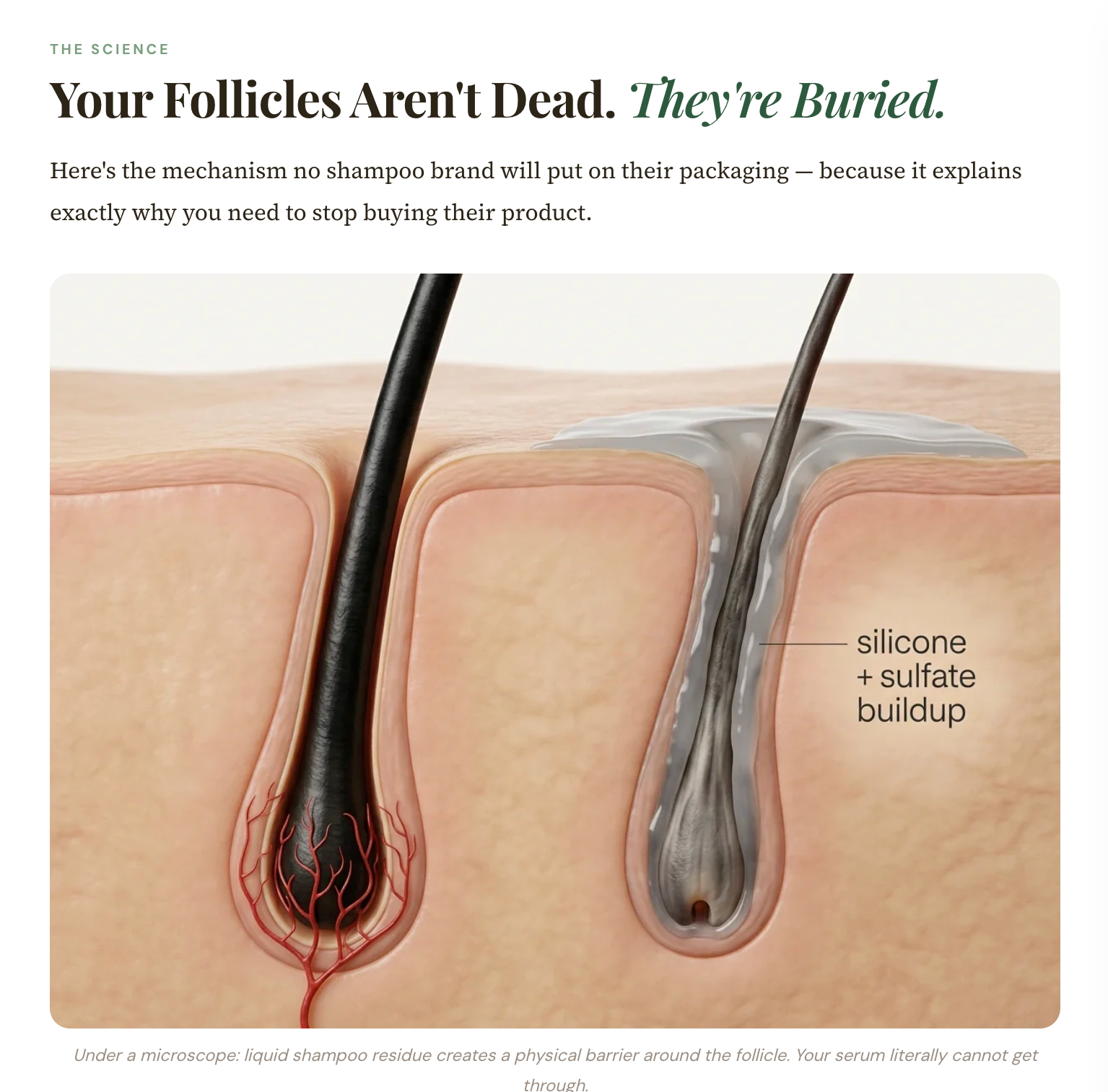 Microneedle Infusion Hair Regrowth Solution