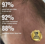 Microneedle Infusion Hair Regrowth Solution